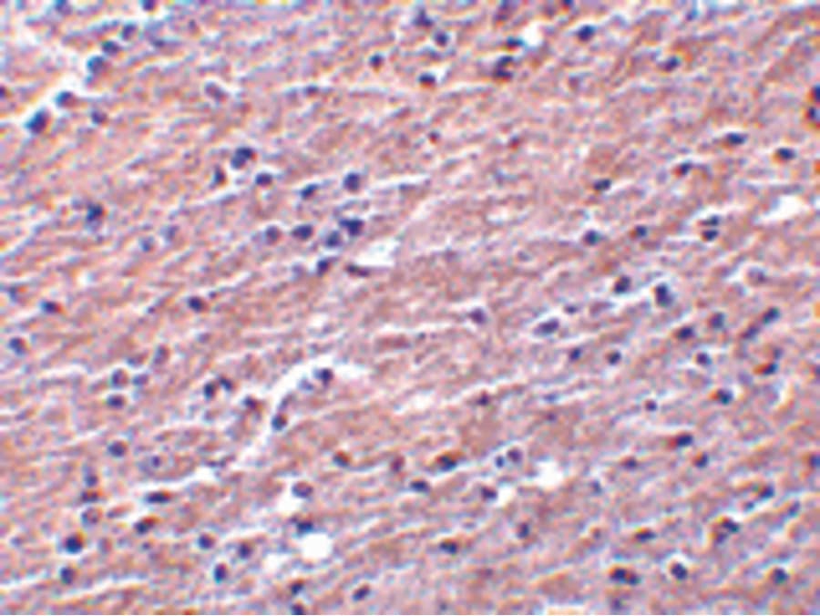CLU / Clusterin Antibody