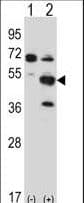 IHC-plus™ Polyclonal Rabbit anti-Mouse PXK Antibody (aa164-193, IHC, WB)