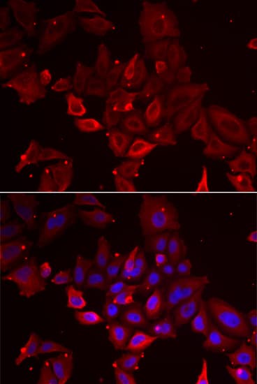 MYOT / Myotilin Antibody