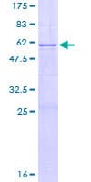Human HYAL1 Protein (Recombinant GST)