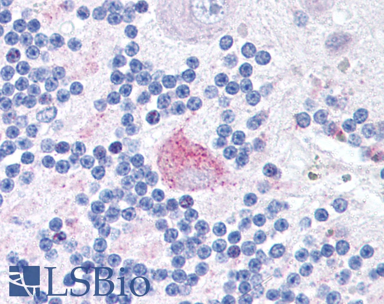 IHC-plus™ FXR2 Antibody (aa414-658, clone 1G2)