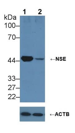 ENO2 / NSE Antibody (aa1-434)