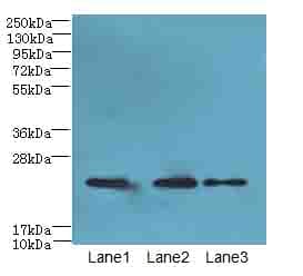 Polyclonal Rabbit anti-Human Claudin 20 / CLDN20 Antibody (WB)