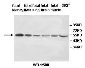 ALG1 Antibody (aa211-462)