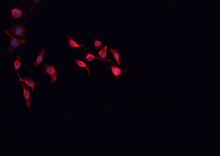 MRC2 / Endo180 Antibody