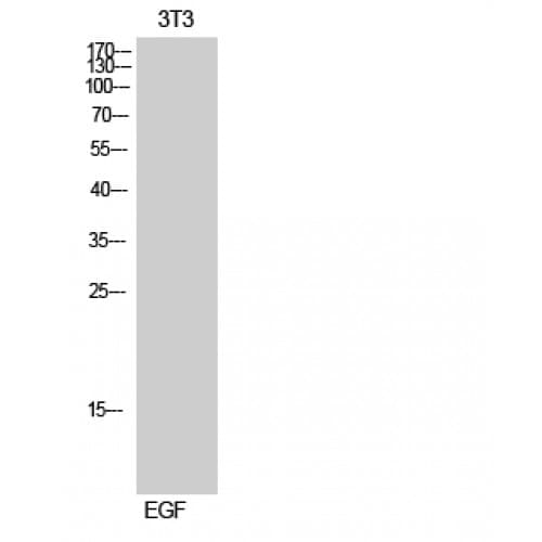 MERTK + TYRO3 Antibody (690-770 aa)