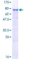 Human ALPPL2 Protein (Recombinant GST)