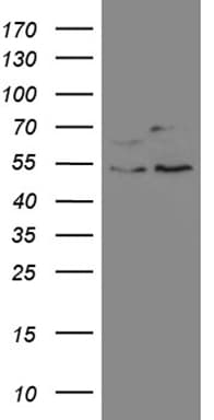 SS18 Antibody (aa227-255, clone OTI4F11, Carrier-free)