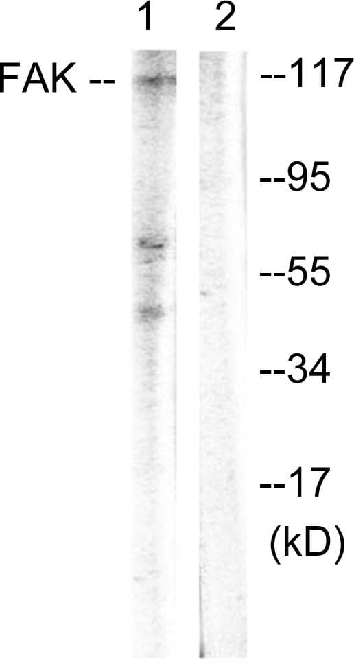 FAK / Focal Adhesion Kinase Antibody (p397)