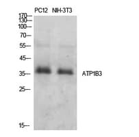 ATP1B3 Antibody