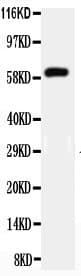 HNF1B / HNF1 Beta Antibody (aa494-509)