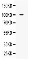 Polyclonal Rabbit anti-Human CAST / Calpastatin Antibody (IHC, WB)