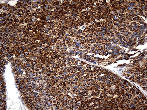 STBD1 Antibody (aa24-358, clone OTI2F1)