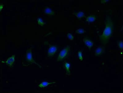 Polyclonal Rabbit anti-Human CCDC108 Antibody (Coiled-coil domain, IHC, WB)