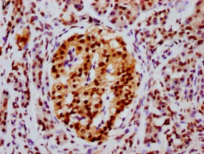 HIST1H4I Antibody