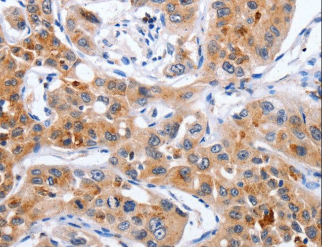 NCK1 / NCK Antibody