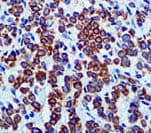 Monoclonal Mouse anti-Human Keratin, LMW Antibody (clone CAM 5.2, Ready-to-Use, IHC)