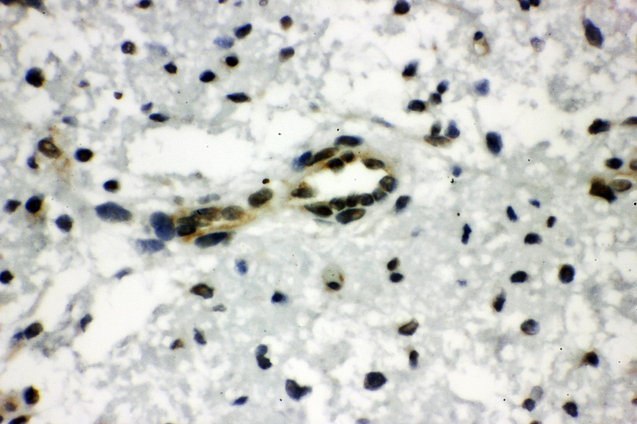 CTBP1 / CTBP Antibody (aa425-440)