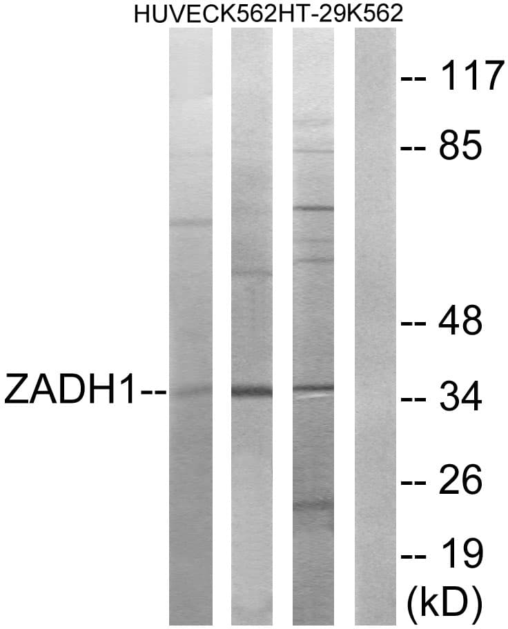 Polyclonal Rabbit anti-Human PTGR2 / PGR2 Antibody (aa181-230, WB)