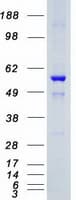 Human SGK3 Protein (Recombinant Myc-DDK (Flag))
