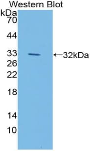 LIPG / Endothelial Lipase Antibody (aa115-369)