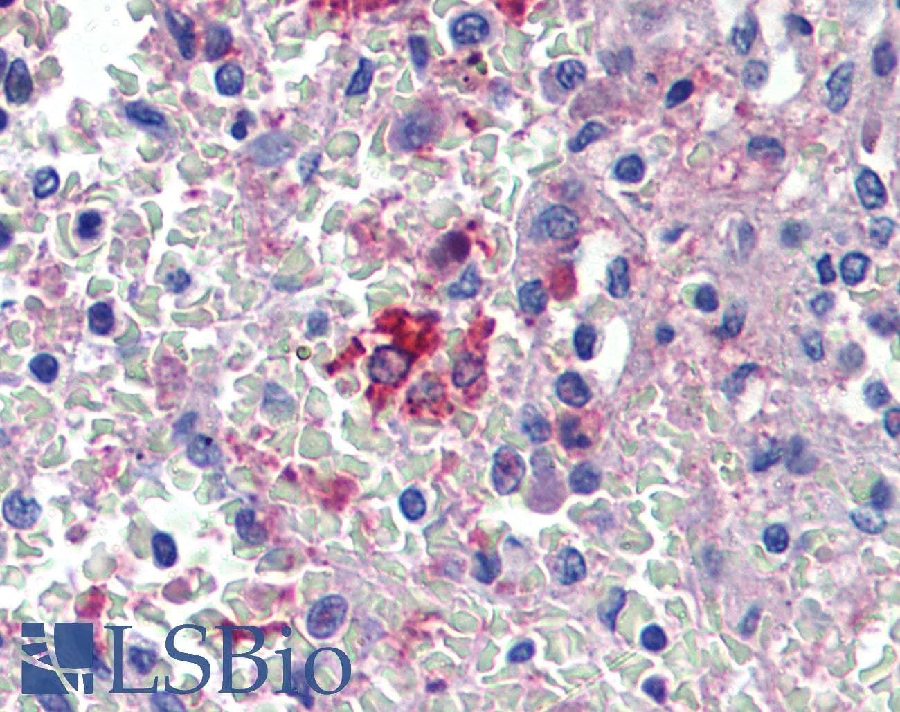 IHC-plus™ HMOX1 / HO-1 Antibody