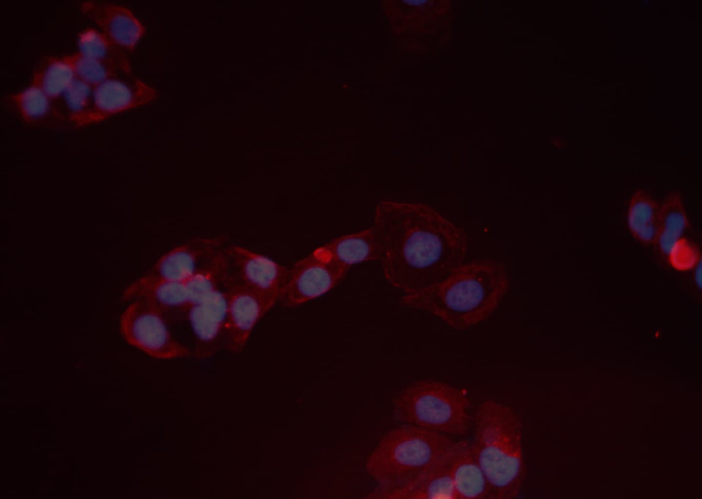 AKT1 Antibody (phospho-Ser473)
