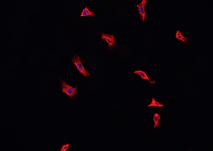 ANXA2 / Annexin A2 Antibody (phospho-Ser26)