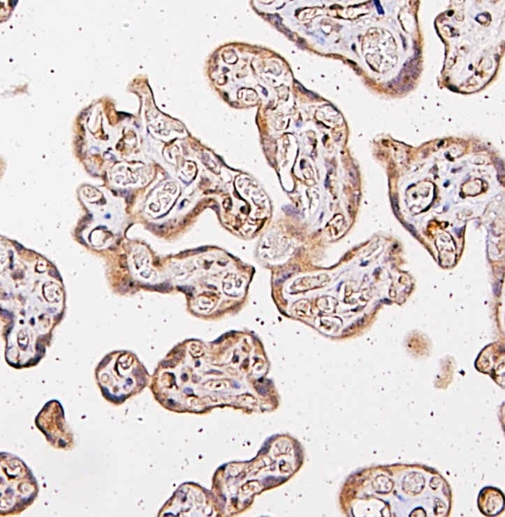 Polyclonal Rabbit anti-Human CARS1 / CARS Antibody (WB)