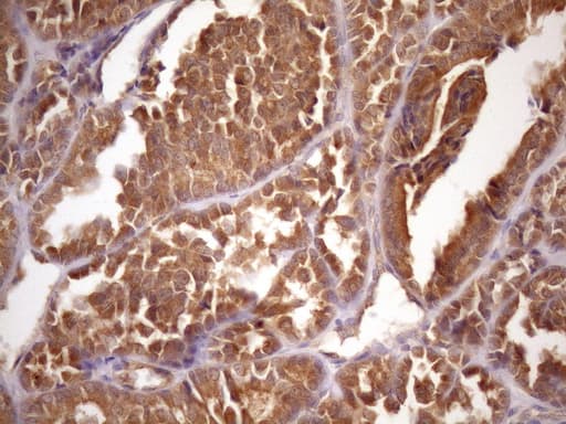 ASB2 Antibody (aa1-300, clone OTI2A2, Carrier-free)