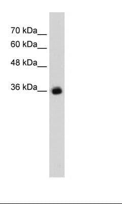 GABRG2 Antibody (aa334-383)