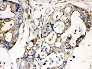 PLEC / Plectin Antibody