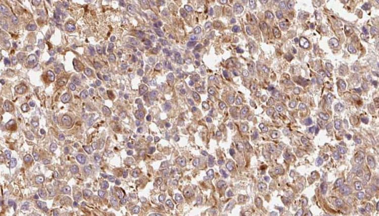 Polyclonal Rabbit anti-Human IL17F Antibody (IHC, IF, WB)