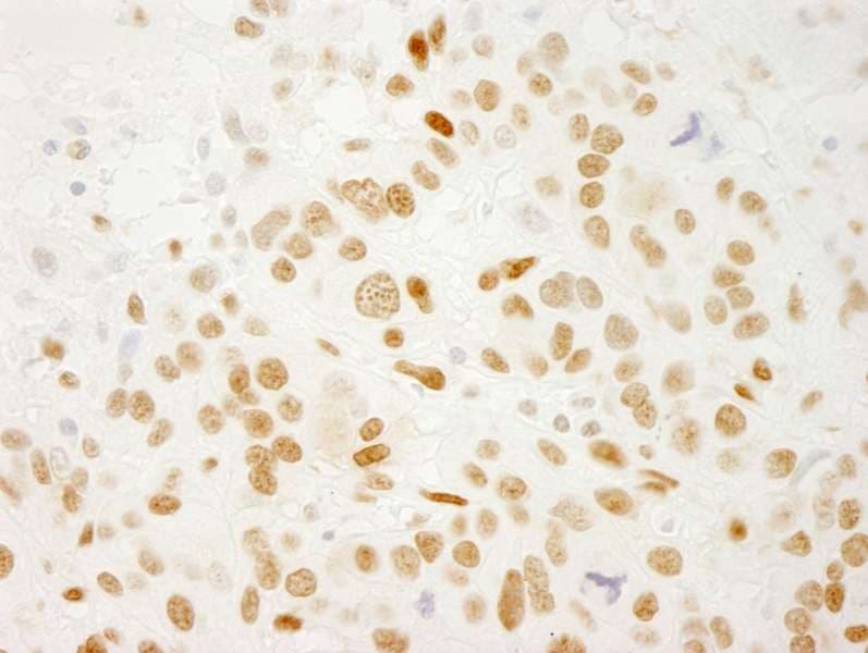 QKI Antibody (C-Terminus)