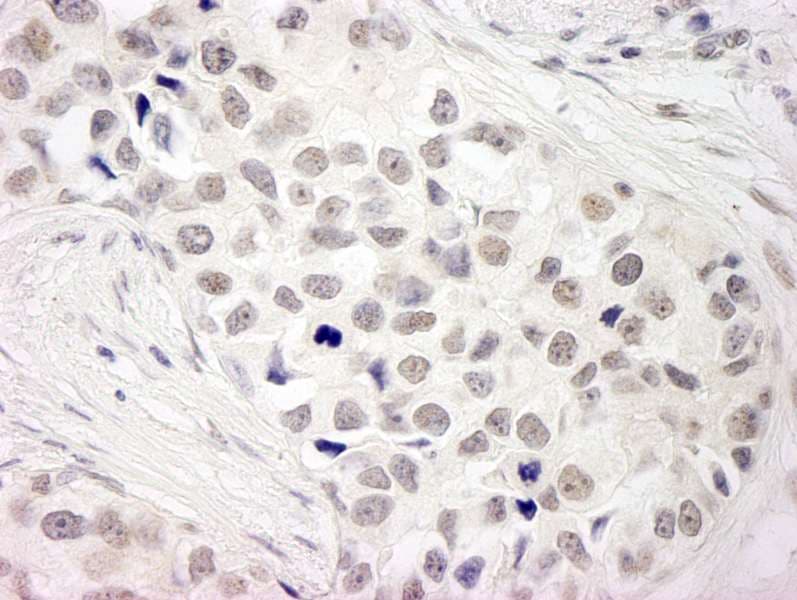 NCOA5 Antibody (aa525-C-term)