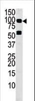 MARK4 Antibody (aa611-641)