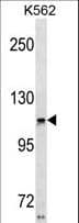 Harmonin / USH1C Antibody (aa1-30)