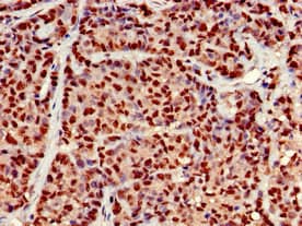 KIAA1970 / EARS2 Antibody