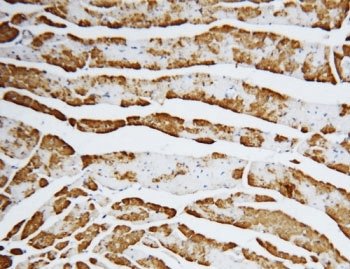 FABP3 / H-FABP Antibody (aa119-133)