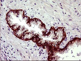 PDGFRB / PDGFR Beta Antibody (clone OTI1E8, Carrier-free)