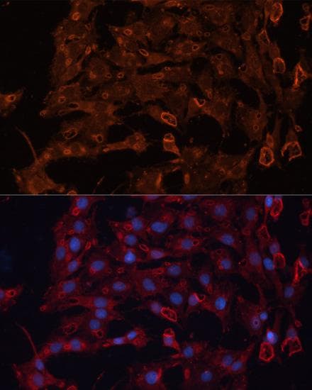ABCB11 / BSEP Antibody