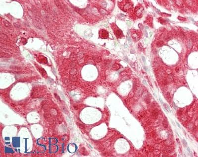IHC-plus™ Monoclonal Mouse anti-Human LGALS9 / Galectin 9 Antibody (clone 21B5, IHC, WB)