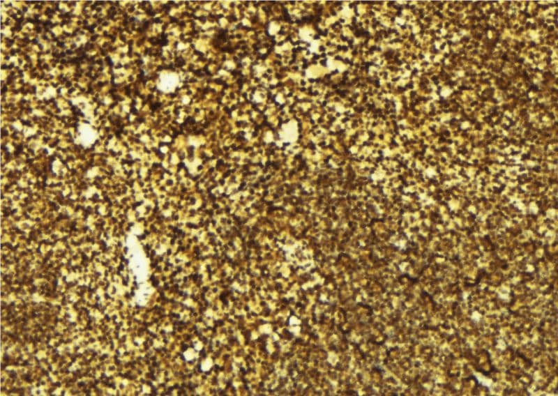Polyclonal Rabbit anti-Human DNMT3B Antibody (IHC, IF, WB)