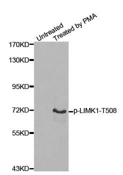 LIMK1 / LIMK Antibody (phospho-Thr508)