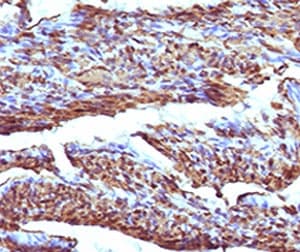 Calponin Antibody (clone RMCN1-1)