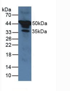 SERPINA1 / Alpha 1 Antitrypsin Antibody
