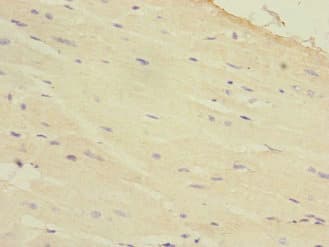 Polyclonal Rabbit anti-Human HAND1 Antibody (IHC)