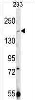 IHC-plus™ Polyclonal Rabbit anti-Human TRPM7 Antibody (aa1821-1850, IHC, WB)