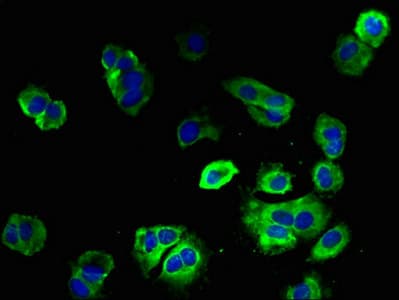 Polyclonal Rabbit anti-Human ENTPD3 Antibody