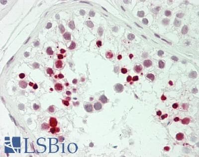 IHC-plus™ BATF2 / SARI Antibody (C-Terminus)